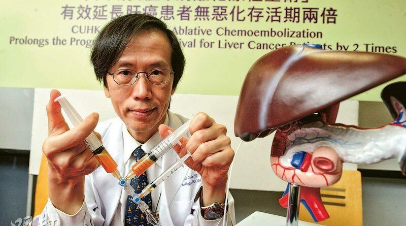【肝炎與肝癌】中大新法減肝癌細胞 原位復發減至4.8%