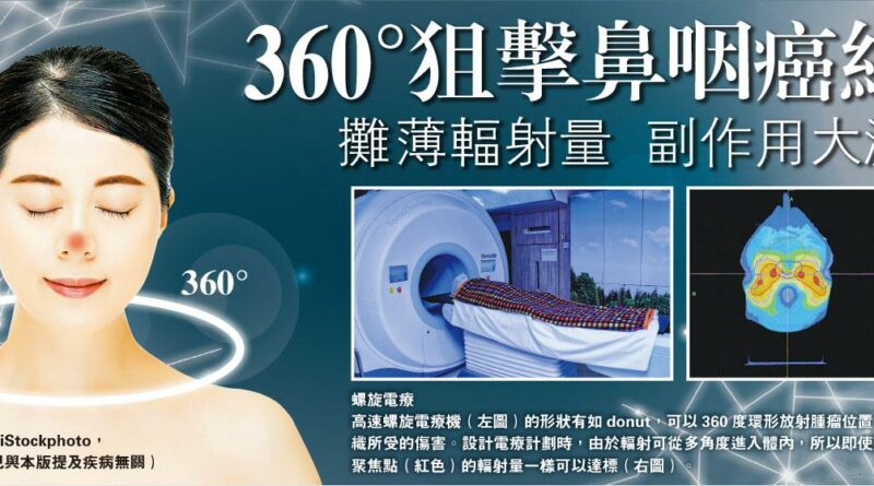 360°狙擊鼻咽癌細胞 攤薄輻射量 副作用大減