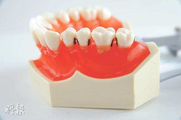 醫徹中西：牙醫學中醫有什麼用？