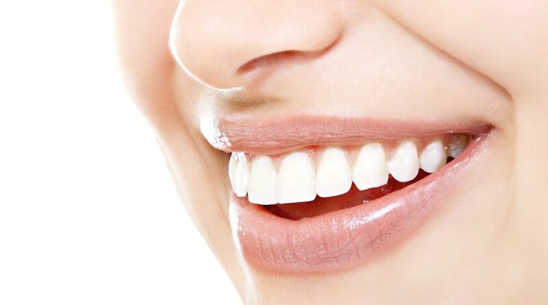 【容光煥發新一年】 牙齒變黃、蛀牙問題多 牙醫利用數碼技術 打造自信笑容