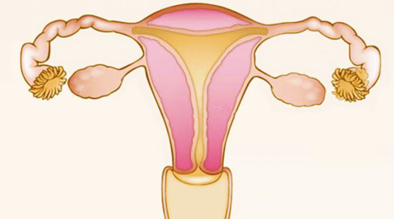 【女性疾病】 子宮體癌及卵巢癌有上升趨勢 婦科癌體內放療 近距離滅癌減影響