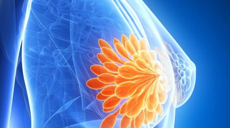 【女性疾病】 乳癌術前化療助縮瘤 新標靶藥提升治癒率