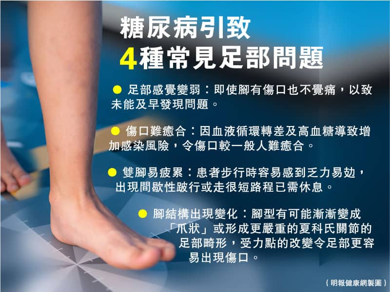【糖尿病】血糖失控隨時變糖尿足 提防4個警號 日常護理雙腳有法 免爛腳截肢