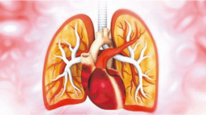 【急性肺栓塞】急性肺栓塞徵狀：突然呼吸困難、胸痛及咳血 殺人不留痕（醫路同行）