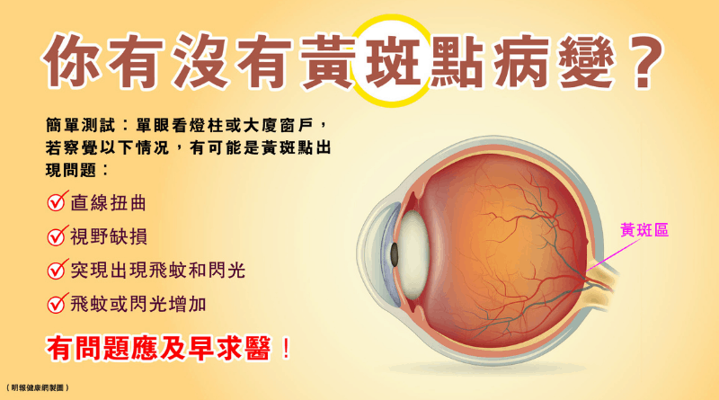 黃斑點病變 深近視屬高危 昔日致盲眼疾 今激光、超微創手術助挽救視力