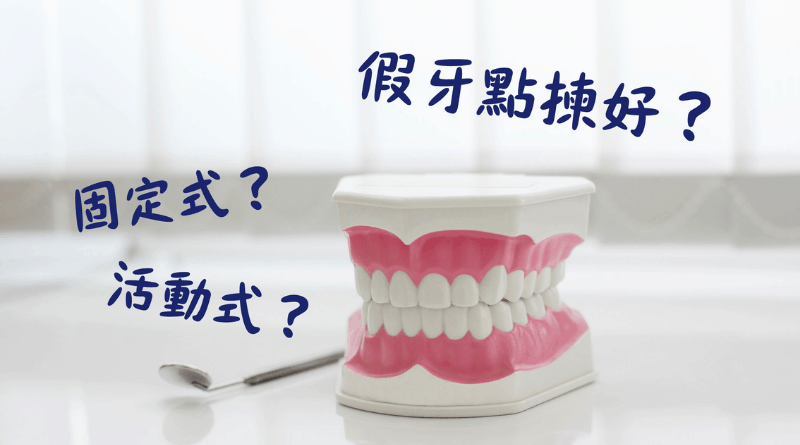 【假牙種類】「固定式」？「活動式」？了解各類型假牙 詳細評估助裝配