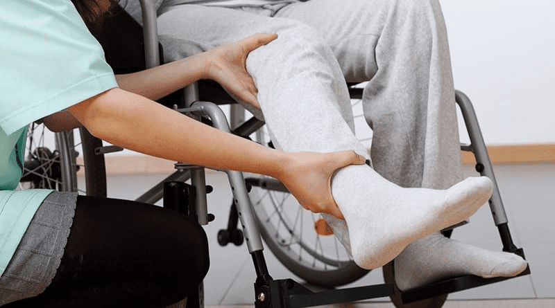 中風復康矯形用具 義肢矯形師度身訂做手托、腳托減肌肉攣縮 提升復康效果