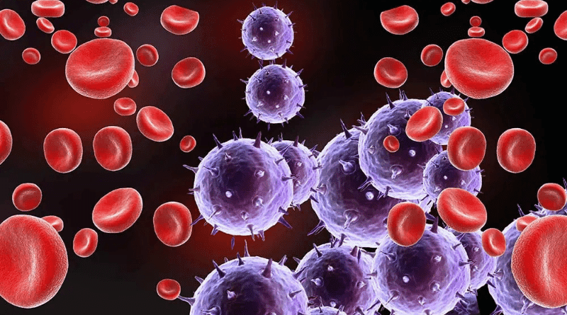 血癌患者感染新冠病毒 易出現重症死亡風險高 或影響治療計劃（醫言有理）