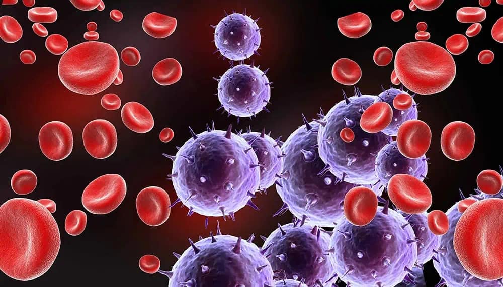 醫學界大致將血癌分成三大類，包括：白血病、骨髓瘤及淋巴瘤。