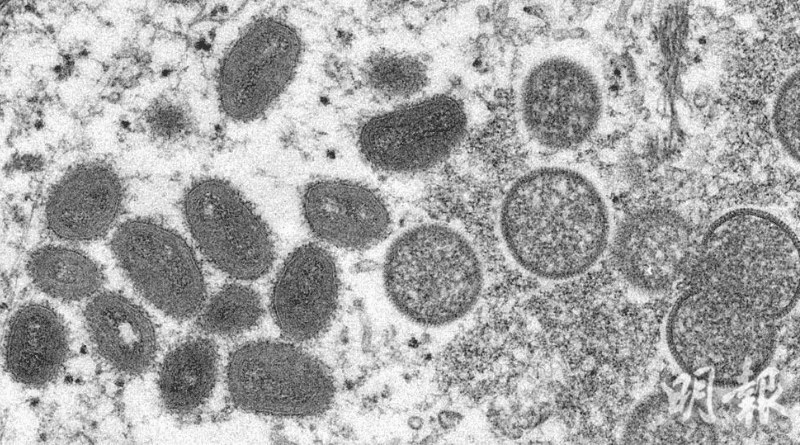 【猴痘】新加坡韓國陸續出現猴痘個案 新一波擴至亞洲