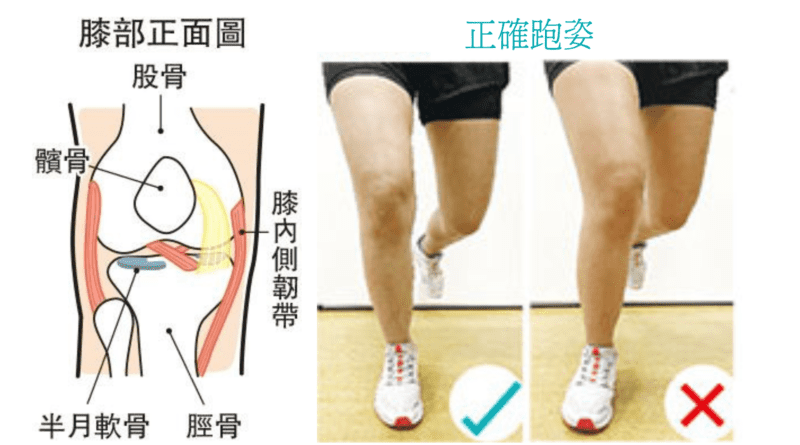 【膝痛】跑步姿勢不當3原因 肌肉不平衡?扁平足致膝關節內旋?正確跑姿話你知 (姿錯能改)