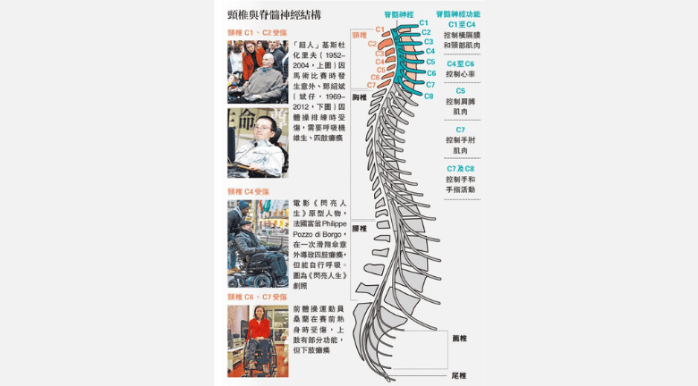 頸椎骨折移位 脊髓受損 了解機械腳復康治療