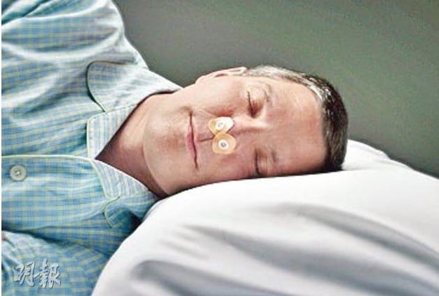 睡眠窒息症可致短暫停止呼吸 港大引入新頜骨手術針對中至嚴重患者 六成治癒