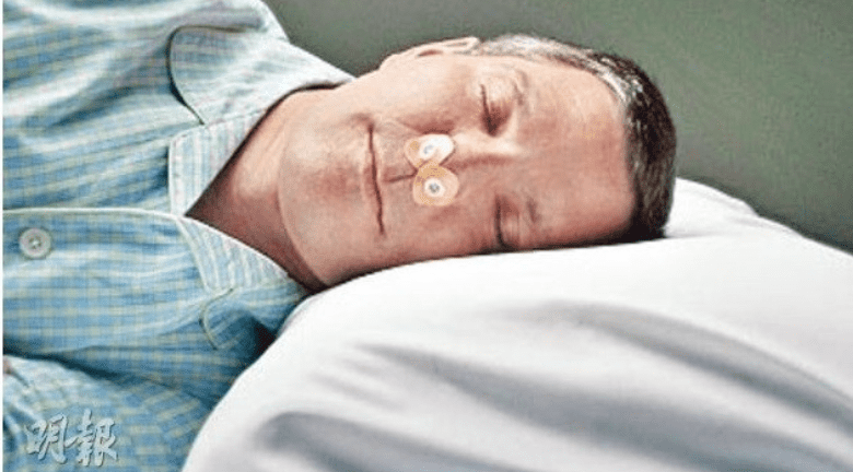 睡眠窒息症可致短暫停止呼吸 港大引入新頜骨手術針對中至嚴重患者 六成治癒