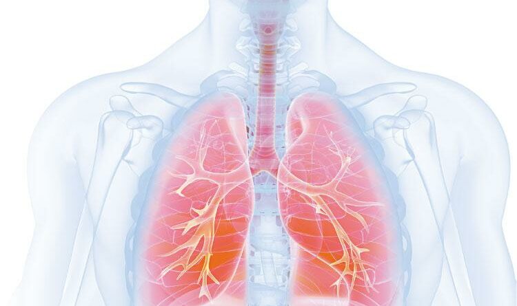 【了解肺癌】混合治療新方案 肺癌四期 未必是盡頭