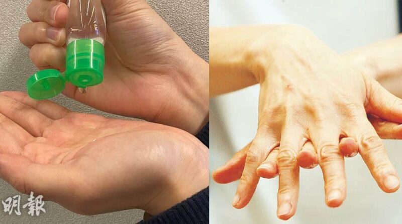 【武漢肺炎】搓手液愈多愈有效？醫生提醒：搓手時間覆蓋範圍更重要